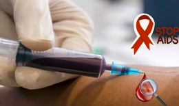 Tầm quan trọng của c&#225;c loại x&#233;t nghiệm HIV trong kiểm so&#225;t v&#224; quản l&#253; bệnh