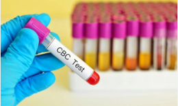 Những chỉ số máu quan trọng giúp quản lý HIV hiệu quả