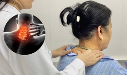 Nguy cơ liệt nếu không điều trị thoát vị đĩa đệm