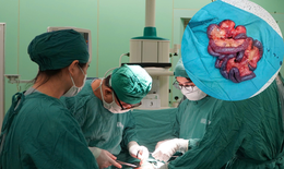 Nam bệnh nh&#226;n hoại tử gần 5m ruột non do tắc động mạch hiếm gặp