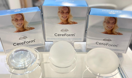 Túi ngực Cereform đạt chuẩn châu Âu chính thức phân phối tại Việt Nam