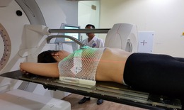 Mặt tr&#225;i của xạ trị v&#224; h&#243;a trị: Hiểm họa ung thư thứ ph&#225;t