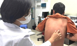 Tự chữa vảy nến, bệnh nhân không đi lại được, phải nằm cáng nhập viện