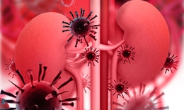 HIV v&#224; bệnh thận mạn t&#237;nh: Những điều n&#234;n biết