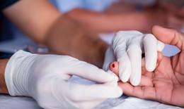 X&#233;t nghiệm HIV c&#243; được bảo mật kh&#244;ng?