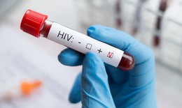 Cửa sổ huyết thanh c&#243; &#253; nghĩa g&#236; trong x&#233;t nghiệm HIV?