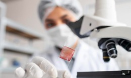 Liệu c&#243; thể chữa ung thư bằng c&#225;ch điều chỉnh vi sinh trong m&#244; u?