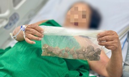 Đặt mua củ ấu tẩu tr&#234;n mạng để chữa khớp, người phụ nữ su&#253;t tử vong