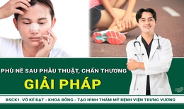 Hiểu đúng về phù nề để tránh biến chứng không đáng có