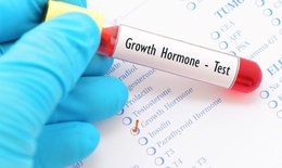 Trẻ thấp l&#249;n do thiếu hụt hormone tăng trưởng