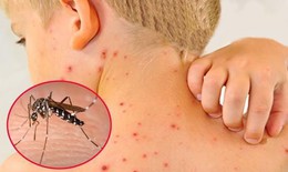 Đ&#227; c&#243; hơn 86.000 ca mắc sốt xuất huyết, bệnh ng&#224;y c&#224;ng kh&#243; lường hơn do biến đổi kh&#237; hậu