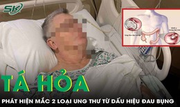 Người đ&#224;n &#244;ng 65 tuổi t&#225; hỏa ph&#225;t hiện mắc đồng thời 2 loại ung thư từ triệu chứng đau bụng