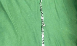 Nội soi gắp dị vật l&#224; v&#242;ng bạc trong dạ d&#224;y b&#233; g&#225;i 5 tuổi