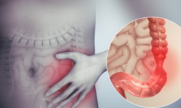 Vi&#234;m&#160;đại&#160;tr&#224;ng&#160;co&#160;thắt&#160;c&#243;&#160;nguy&#160;hiểm&#160;kh&#244;ng?