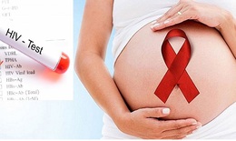 Những điều cần biết về chăm s&#243;c b&#224; mẹ c&#243; HIV ngay sau sinh
