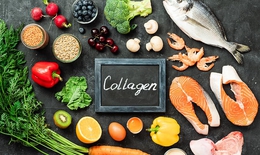 8 nguồn collagen tự nhiên từ thực phẩm nên bổ sung hằng ngày