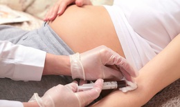 C&#225;c x&#233;t nghiệm s&#224;ng lọc trước sinh Hội chứng Down