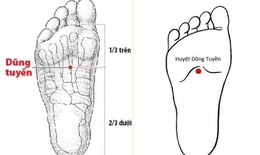 B&#225;c sĩ y học cổ truyền khuyến c&#225;o một số biện ph&#225;p ph&#242;ng ngừa đột quỵ v&#224;o m&#249;a lạnh