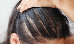 Bí quyết ngăn rụng tóc và kích thích tóc mọc nhanh tại nhà
