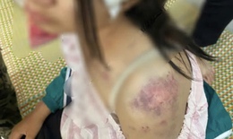 Góc pháp lý vụ bà nội bạo hành cháu gái ở Thái Nguyên