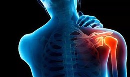 B&#224;i tập n&#224;o giảm đau vai nhanh?