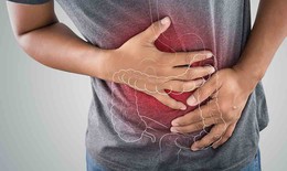 Dấu hiệu thường gặp của vi&#234;m lo&#233;t đại trực tr&#224;ng 