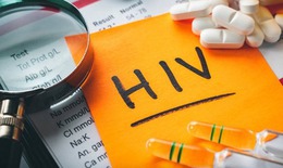 Chuyên gia chỉ cách phòng các bệnh không lây nhiễm đối với người có HIV