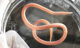 Giun đũa ở người g&#226;y biến chứng nguy hiểm g&#236;, kh&#225;m ở đ&#226;u?