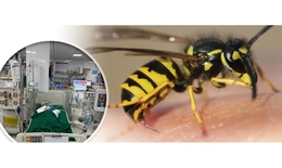 Cứu sống b&#233; g&#225;i bị suy đa tạng do ong v&#242; vẽ đốt 