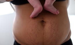 C&#225;c cột mốc hồi phục sức khỏe b&#224; mẹ trong 40 ng&#224;y sau sinh