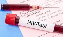 Thực trạng HIV/AIDS ở Việt Nam: Dịch đ&#227; được kiểm so&#225;t nhưng chưa thể chủ quan