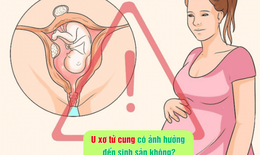 U xơ tử cung có ảnh hưởng đến sinh sản không?