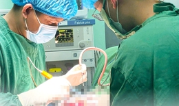 Cứu sống b&#233; g&#225;i 6 tuổi bị chấn thương sọ n&#227;o nặng sau tai nạn ng&#227; xe