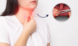 Lợi ích và rủi ro khi cắt amidan