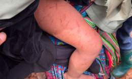 Đêm mưa rét kinh hoàng của bé 4 tuổi lạc trong rừng cao su