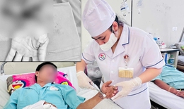 Nối thành công cổ tay đứt lìa: Ca vi phẫu 8 giờ xuyên đêm giành lại cơ thể trọn vẹn cho người bệnh