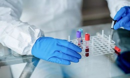 Liệu c&#243; phương ph&#225;p chữa khỏi HIV? Nghi&#234;n cứu mới mở ra hy vọng kiểm so&#225;t virus kh&#244;ng cần d&#249;ng thuốc h&#224;ng ng&#224;y