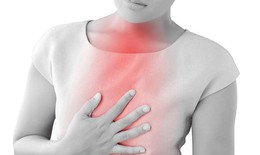 Ợ nóng, ợ chua  khi nào liên quan đến bệnh lý cần lo lắng?