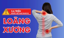 Loãng xương và gãy xương sau 40 tuổi: Nguy cơ âm thầm nhưng có thể phòng ngừa sớm