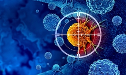 Công nghệ hình ảnh siêu nhạy giúp phát hiện ung thư sớm