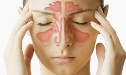 Cách chăm sóc khi bị viêm xoang cấp