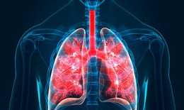 5 triệu chứng thường gặp của bệnh xơ phổi