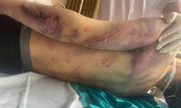 Diễn biến mới vụ học viên tử vong sau 2 ngày nhập học