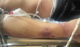 Tạm dừng trung tâm công tác xã hội có học viên tử vong sau 2 ngày nhập học