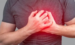 Người bệnh tim mạch cần ăn uống, tập luyện như thế nào để tốt cho sức khỏe trong mùa lạnh?