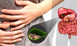 Chế độ ăn kiêng cho bệnh nhân sỏi tiết niệu