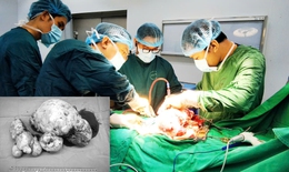 Bất ngờ ph&#225;t hiện u buồng trứng gần 3kg sau chấn thương sọ n&#227;o