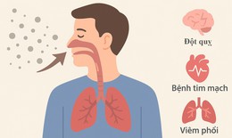 Bụi mịn "đe doạ" phổi và những người mắc bệnh mạn tính như nào?