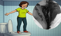 Bồn cầu bất ngờ vỡ khi đứng l&#234;n, b&#233; trai 8 tuổi bị r&#225;ch 25 cm lưng