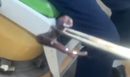 Người đàn ông bất ngờ bị đỉa rừng dài 7cm chui vào hốc mũi